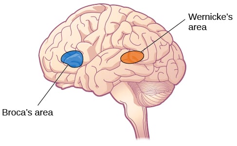 Broca